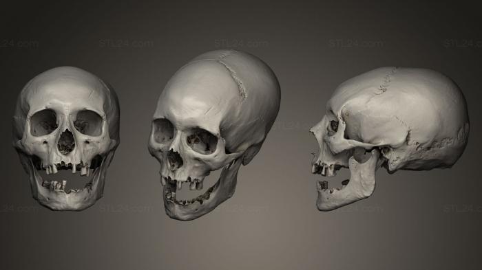 Anatomy of skeletons and skulls (Deformed skull, ANTM_0012) 3D models for cnc